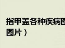指甲盖各种疾病图片和名称（指甲盖各种疾病图片）