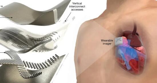 可衣着超声贴片可能在旅途中提供实时心脏扫描