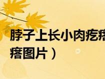 脖子上长小肉疙瘩图片说明（脖子上长小肉疙瘩图片）