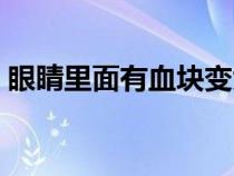 眼睛里面有血块变大变淡（眼睛里面有血块）