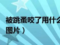 被跳蚤咬了用什么药最有效（被跳蚤咬的症状图片）