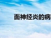面神经炎的病因（面神经炎的表现）