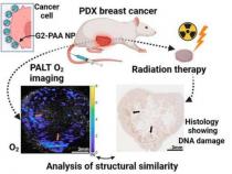 化学成像可以帮助预测放射治疗对个体癌症患者的疗效