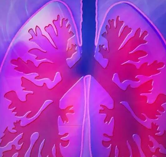 人工智能工具预测肺癌风险