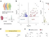 科学家揭示NAD维持在肾脏疾病的保护作用