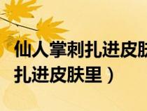 仙人掌刺扎进皮肤里拔不出来怎么办(铅笔芯扎进皮肤里) 仙人掌刺扎进皮肤里拔不出来怎么办(铅笔芯扎进皮肤里)