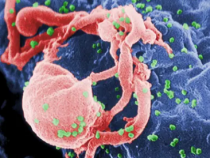工程干细胞抑制活组织中的 HIV
