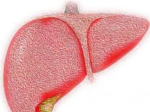 新研究称手术是代谢性肝病最有效的治疗方法