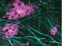 显微镜技术揭示细胞和组织中隐藏的纳米结构
