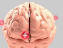 早期血液检查预测死亡 创伤性脑损伤严重残疾