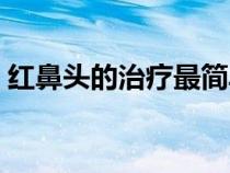 红鼻头的治疗最简单方法（红鼻子怎么治疗）