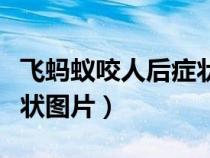 飞蚂蚁咬人后症状图片真实（飞蚂蚁咬人后症状图片）