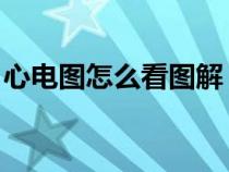 心电图怎么看图解 正常范围（心电图怎么看）