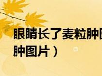 眼睛长了麦粒肿图片怎么办?（眼睛长了麦粒肿图片）